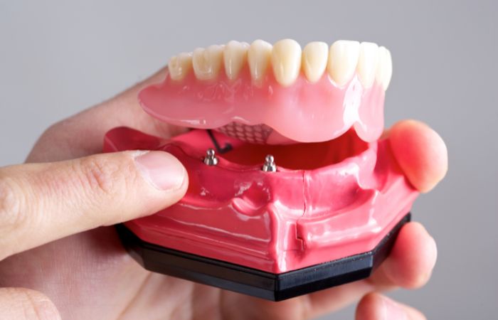 Dentures Treatment