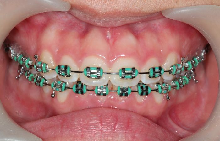 Orthodontics