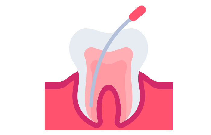 RCT benefits & costs